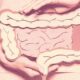 What to Eat When You Have Diarrhea